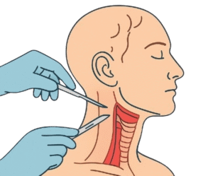 Best head and neck surgeon